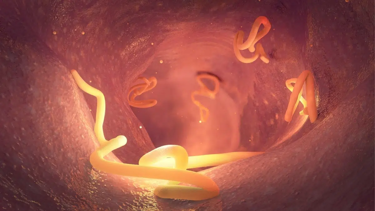 Tapeworms can infest the body through the human intestines.